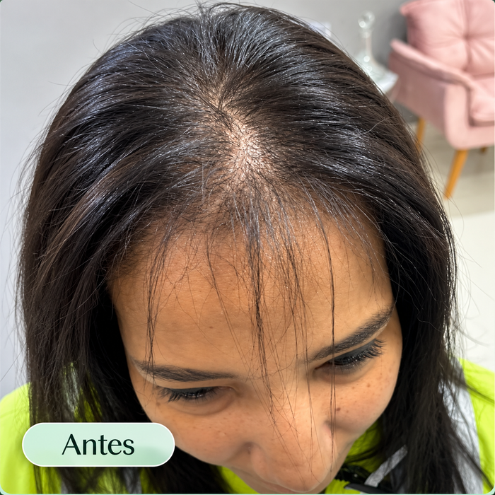 Antes